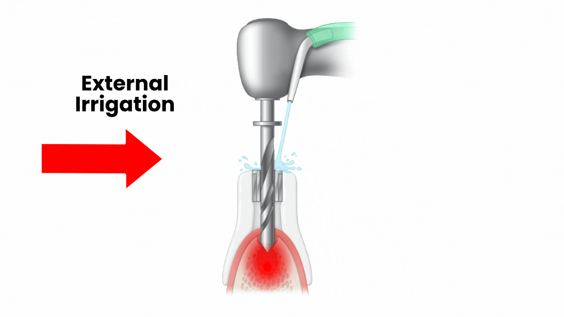 irriguide animated gif