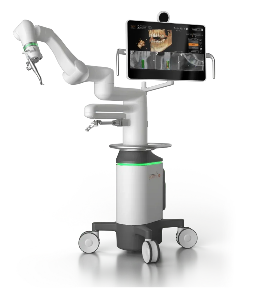 Illustration of Yomi robot dynamic surgical guide